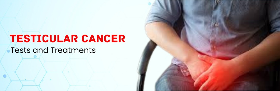 Testicular Cancer Tests and Treatments